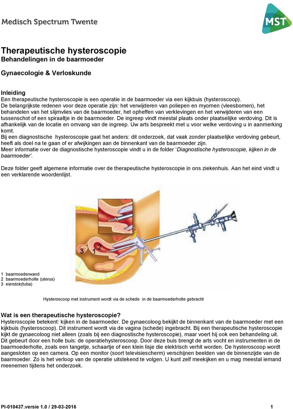 verwijderen van een tussenschot of een spiraaltje in de baarmoeder. De ingreep vindt meestal plaats onder plaatselijke verdoving. Dit is afhankelijk van de locatie en omvang van de ingreep.