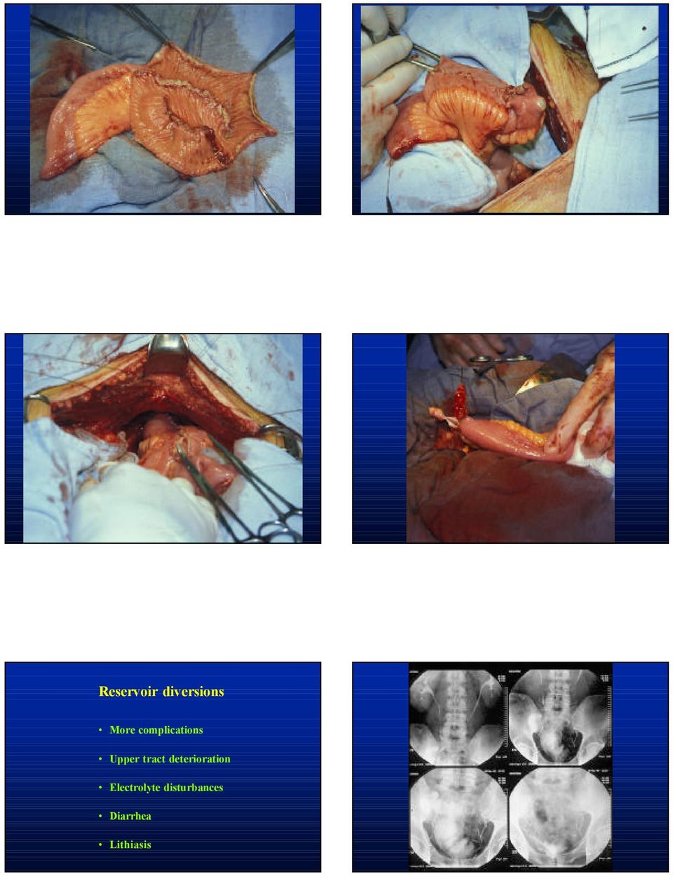 deterioration Electrolyte