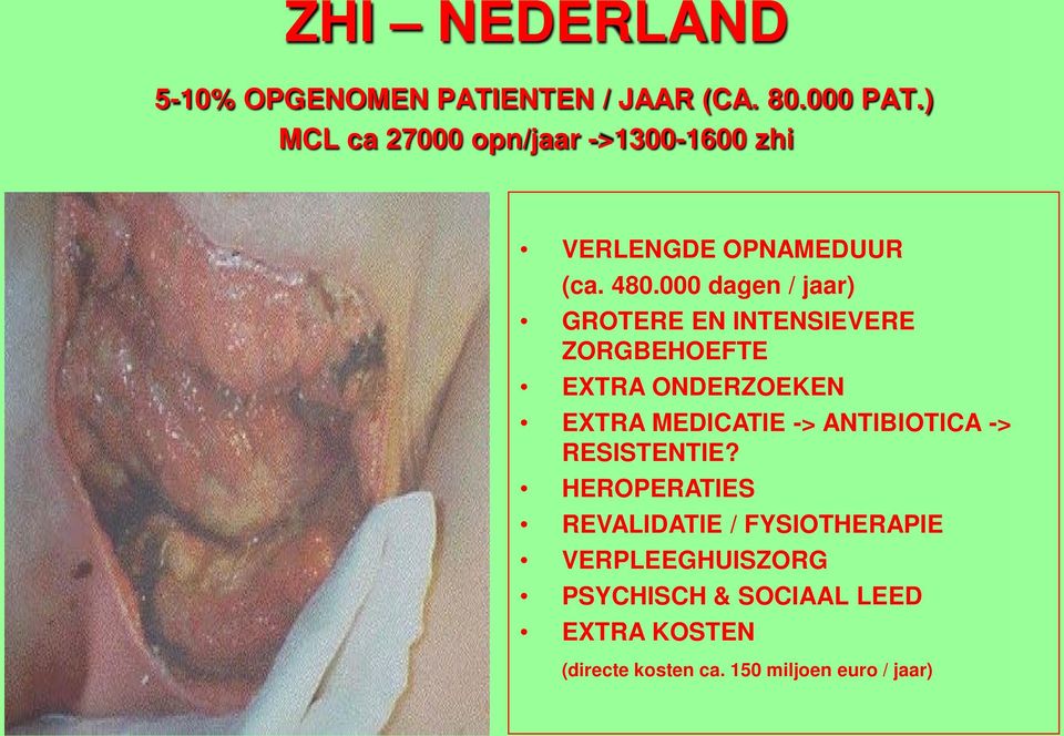 000 dagen / jaar) GROTERE EN INTENSIEVERE ZORGBEHOEFTE EXTRA ONDERZOEKEN EXTRA MEDICATIE ->