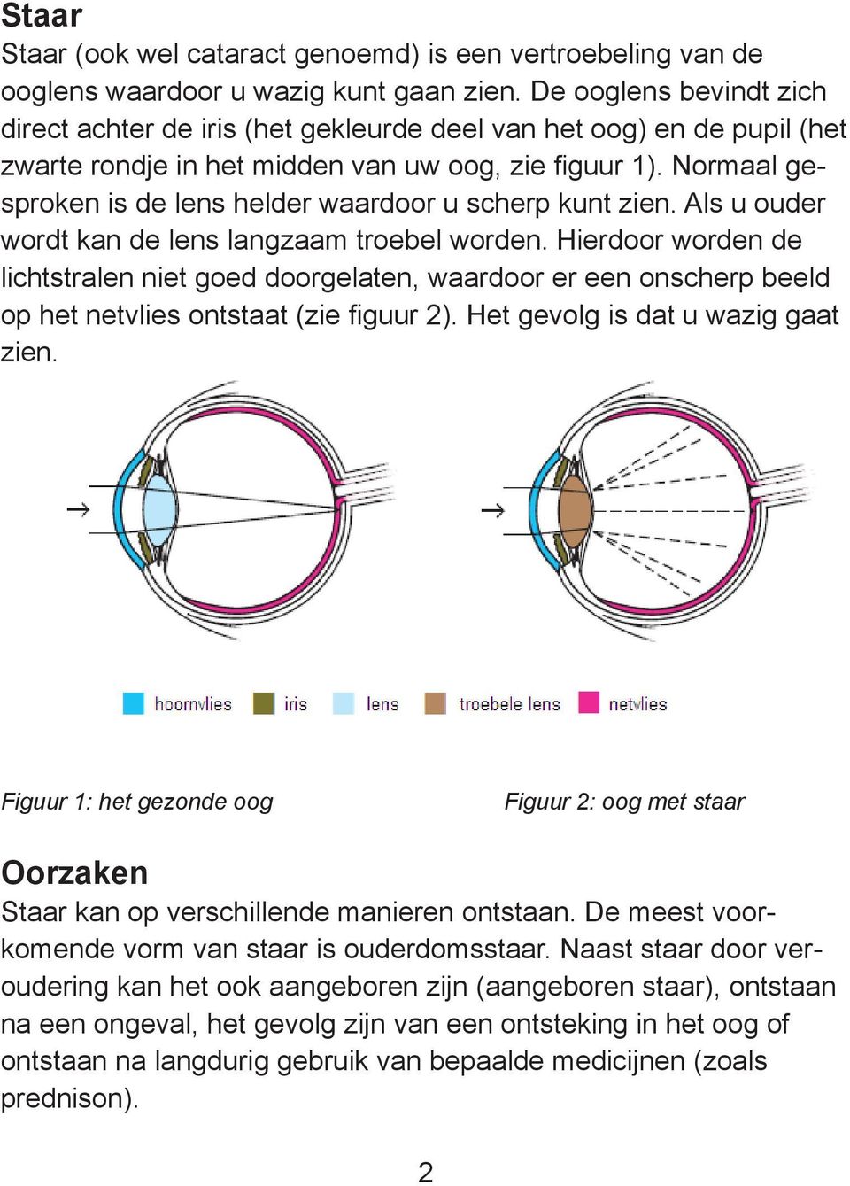 Normaal gesproken is de lens helder waardoor u scherp kunt zien. Als u ouder wordt kan de lens langzaam troebel worden.