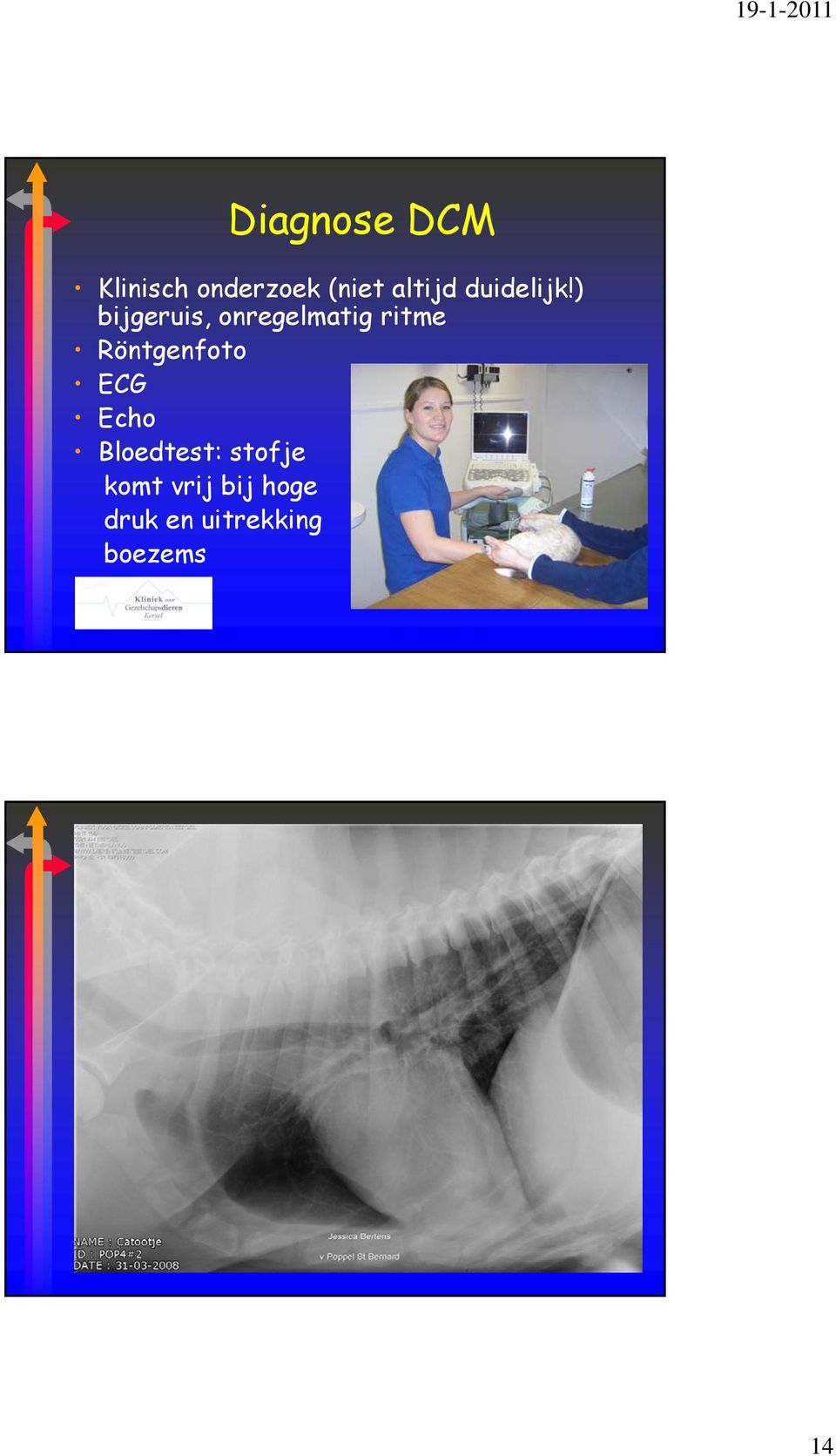 ) bijgeruis, onregelmatig ritme Röntgenfoto