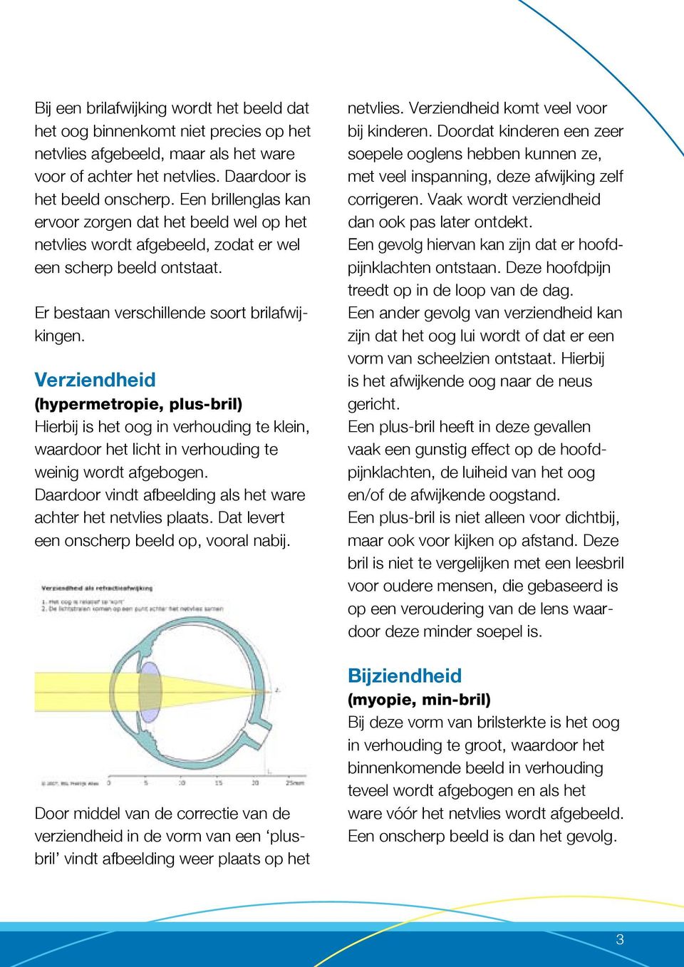 Verziendheid (hypermetropie, plus-bril) Hierbij is het oog in verhouding te klein, waardoor het licht in verhouding te weinig wordt afgebogen.