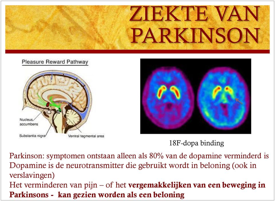 wordt in beloning (ook in verslavingen) Het verminderen van pijn of het