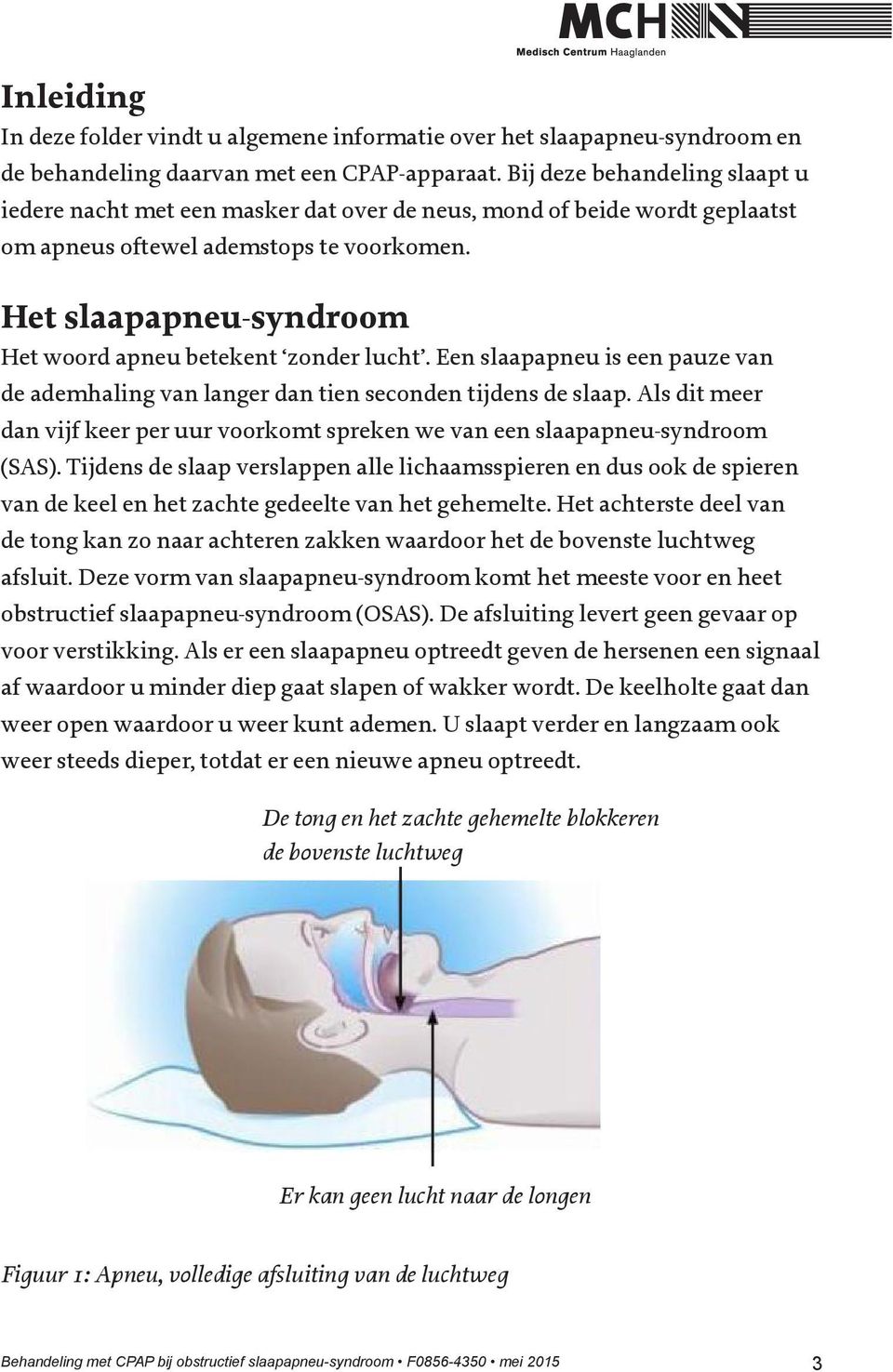 Het slaapapneu-syndroom Het woord apneu betekent zonder lucht. Een slaapapneu is een pauze van de ademhaling van langer dan tien seconden tijdens de slaap.