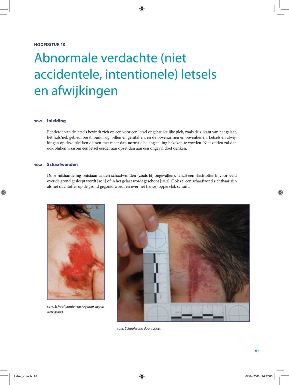 ovenenen. Letsels en fwijkingen op deze plekken dienen met meer dn normle elngstelling ekeken te worden. Niet zelden zl dn ook lijken wrom een letsel eerder n opzet dn n een ongevl doet denken. 10.