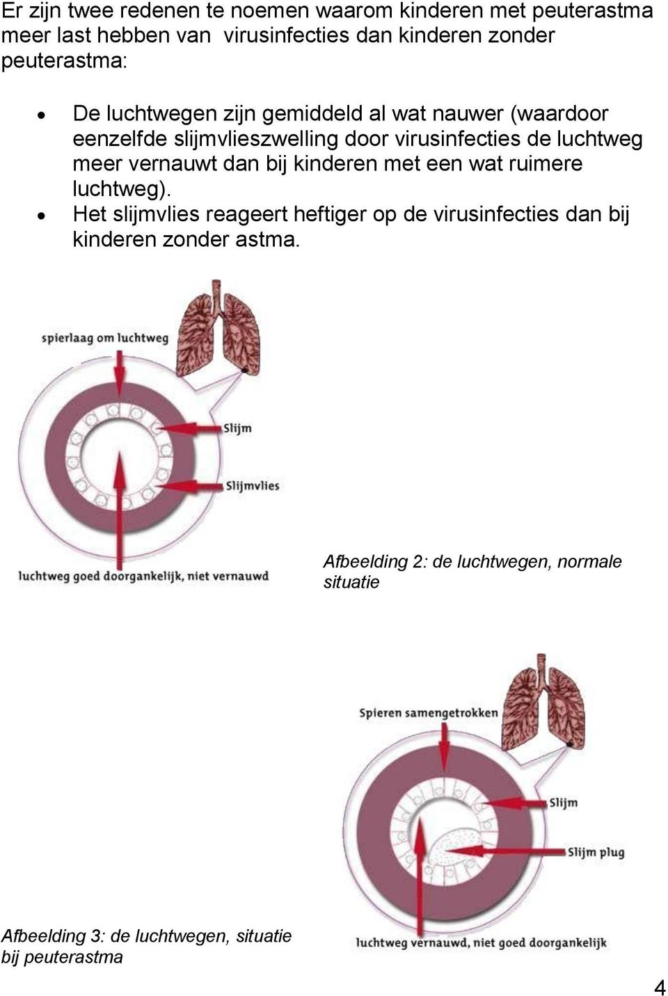 luchtweg meer vernauwt dan bij kinderen met een wat ruimere luchtweg).