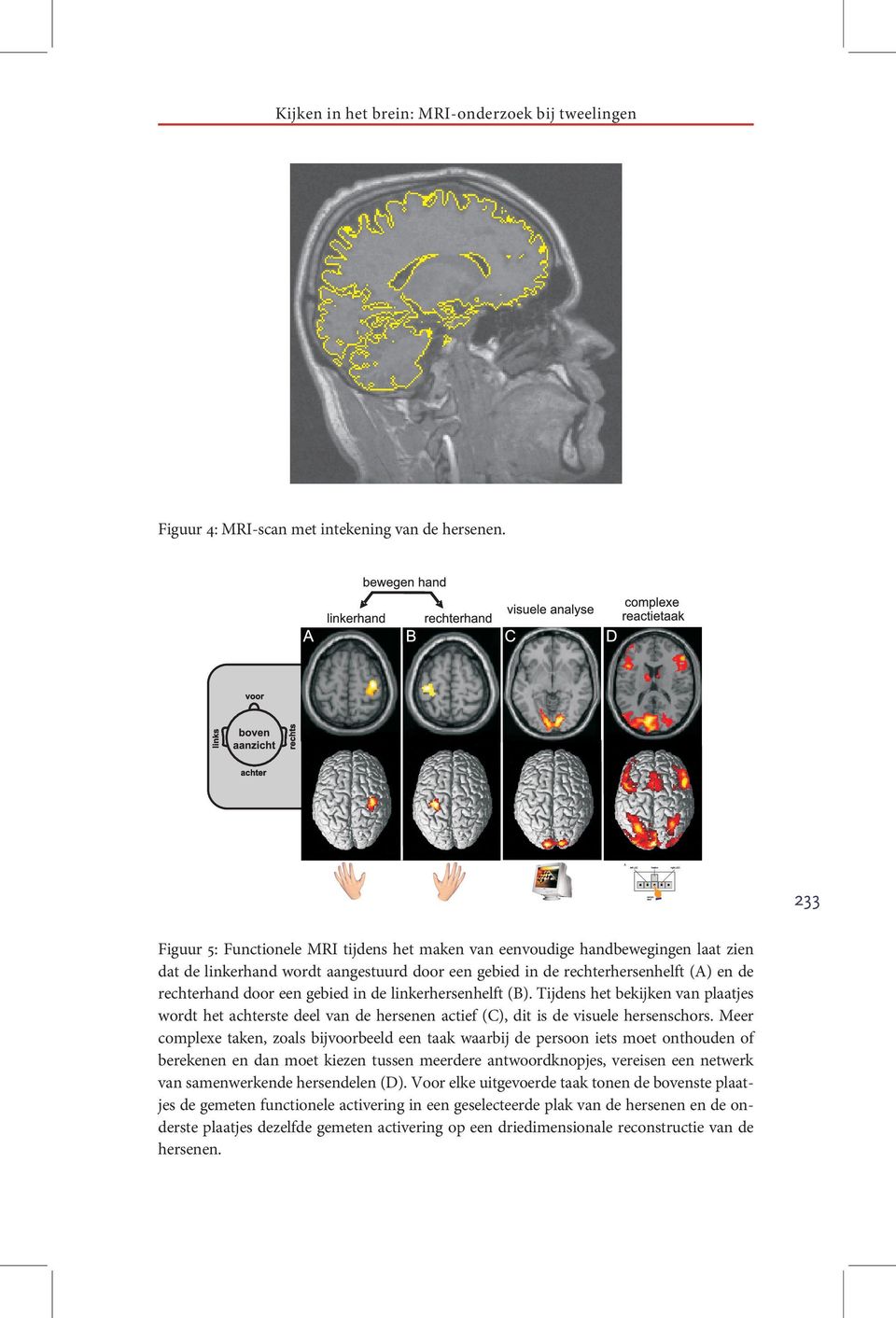 gebied in de linkerhersenhelft (B). Tijdens het bekijken van plaatjes wordt het achterste deel van de hersenen actief (C), dit is de visuele hersenschors.