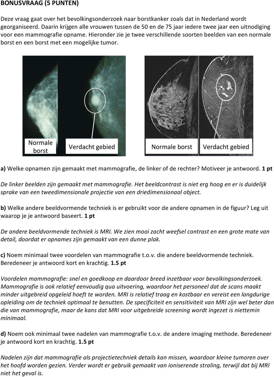 Hieronder zie je twee verschillende soorten beelden van een normale borst en een borst met een mogelijke tumor. a) Welke opnamen zijn gemaakt met mammografie, de linker of de rechter?