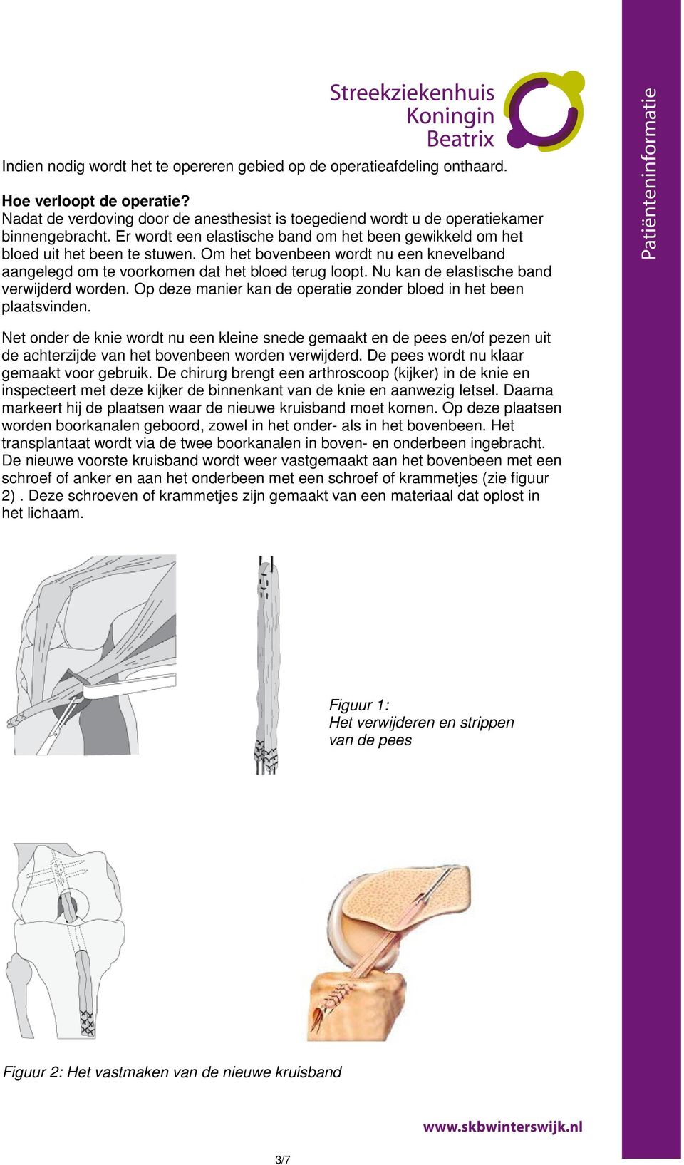 Nu kan de elastische band verwijderd worden. Op deze manier kan de operatie zonder bloed in het been plaatsvinden.