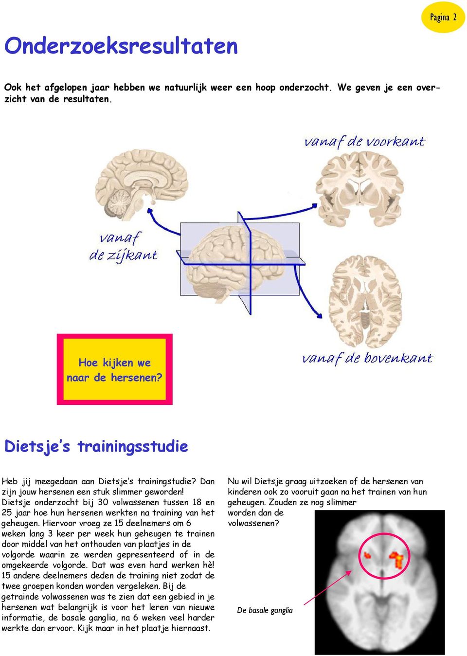 Dietsje onderzocht bij 30 volwassenen tussen 18 en 25 jaar hoe hun hersenen werkten na training van het geheugen.