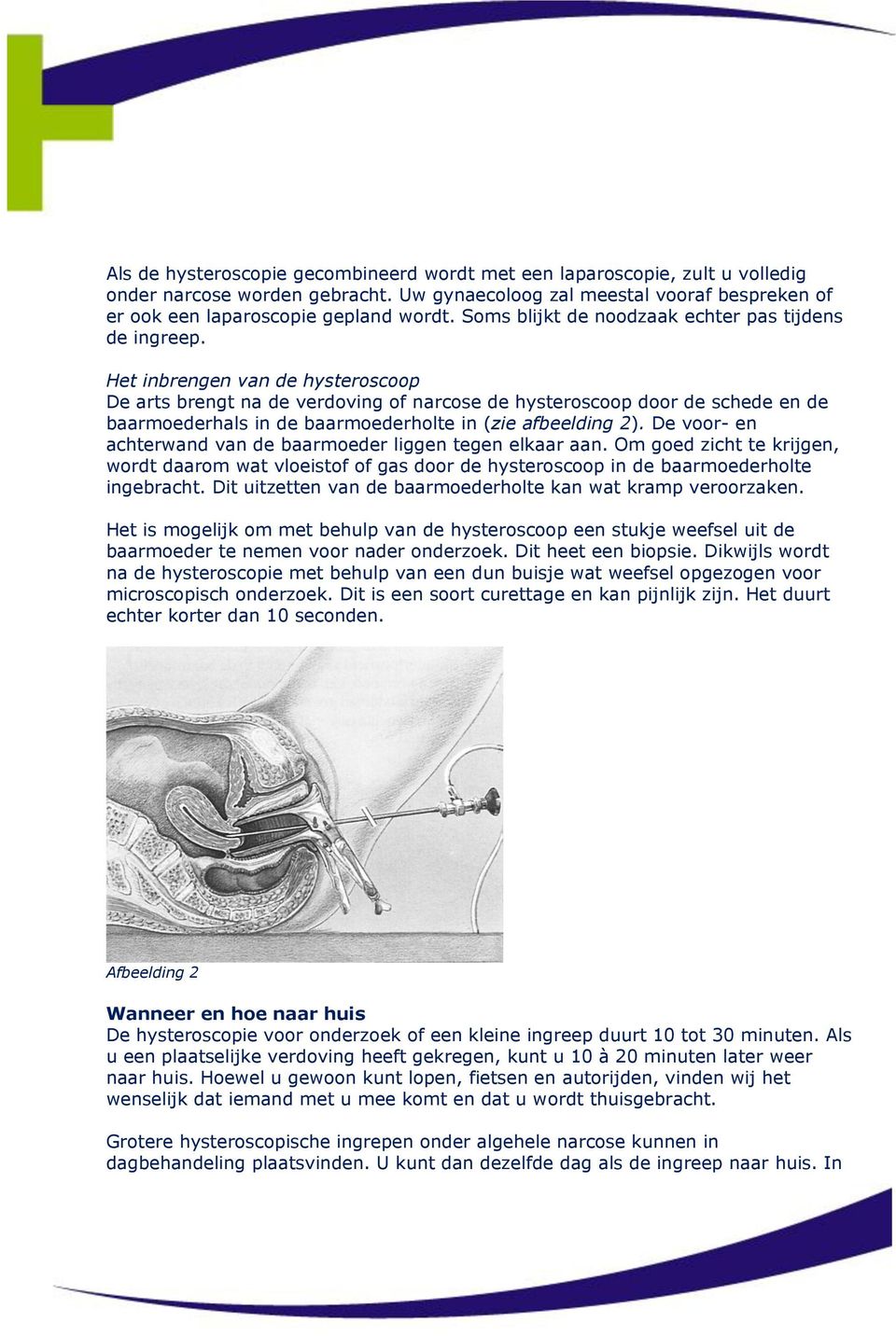 Het inbrengen van de hysteroscoop De arts brengt na de verdoving of narcose de hysteroscoop door de schede en de baarmoederhals in de baarmoederholte in (zie afbeelding 2).