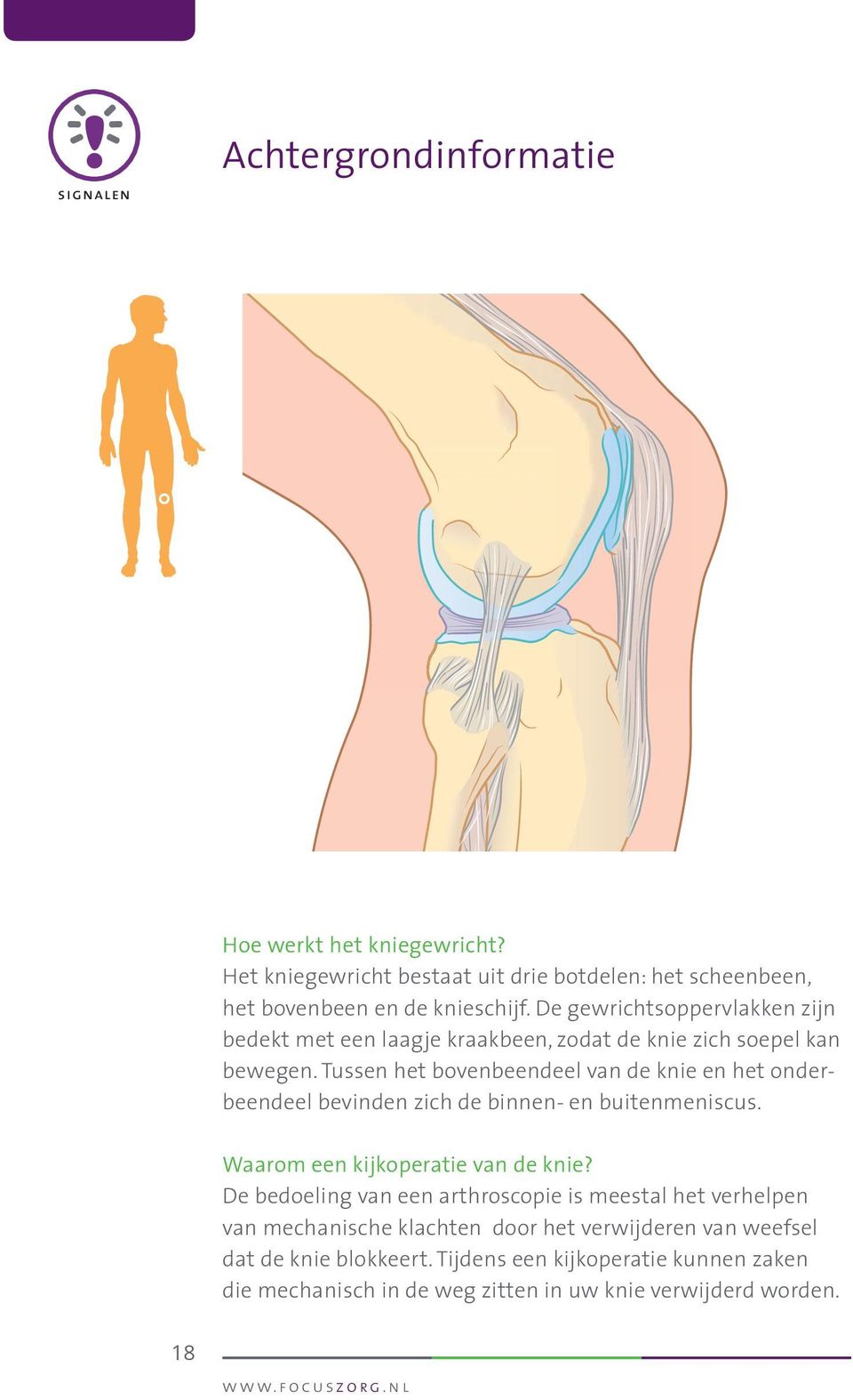 Tussen het bovenbeendeel van de knie en het onderbeendeel bevinden zich de binnen- en buitenmeniscus. Waarom een kijkoperatie van de knie?