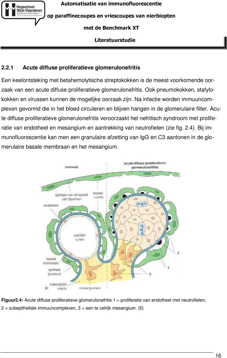 Ook pneumokokken, stafylokokken en virussen kunnen de mogelijke oorzaak zijn. Na infectie worden immuuncomplexen gevormd die in het bloed circuleren en blijven hangen in de glomerulaire filter.