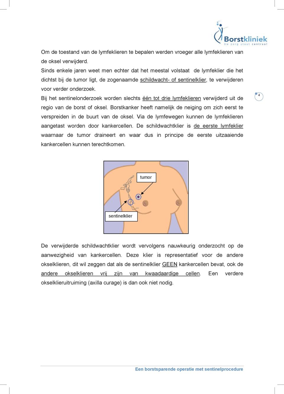 Bij het sentinelonderzoek worden slechts één tot drie lymfeklieren verwijderd uit de regio van de borst of oksel.
