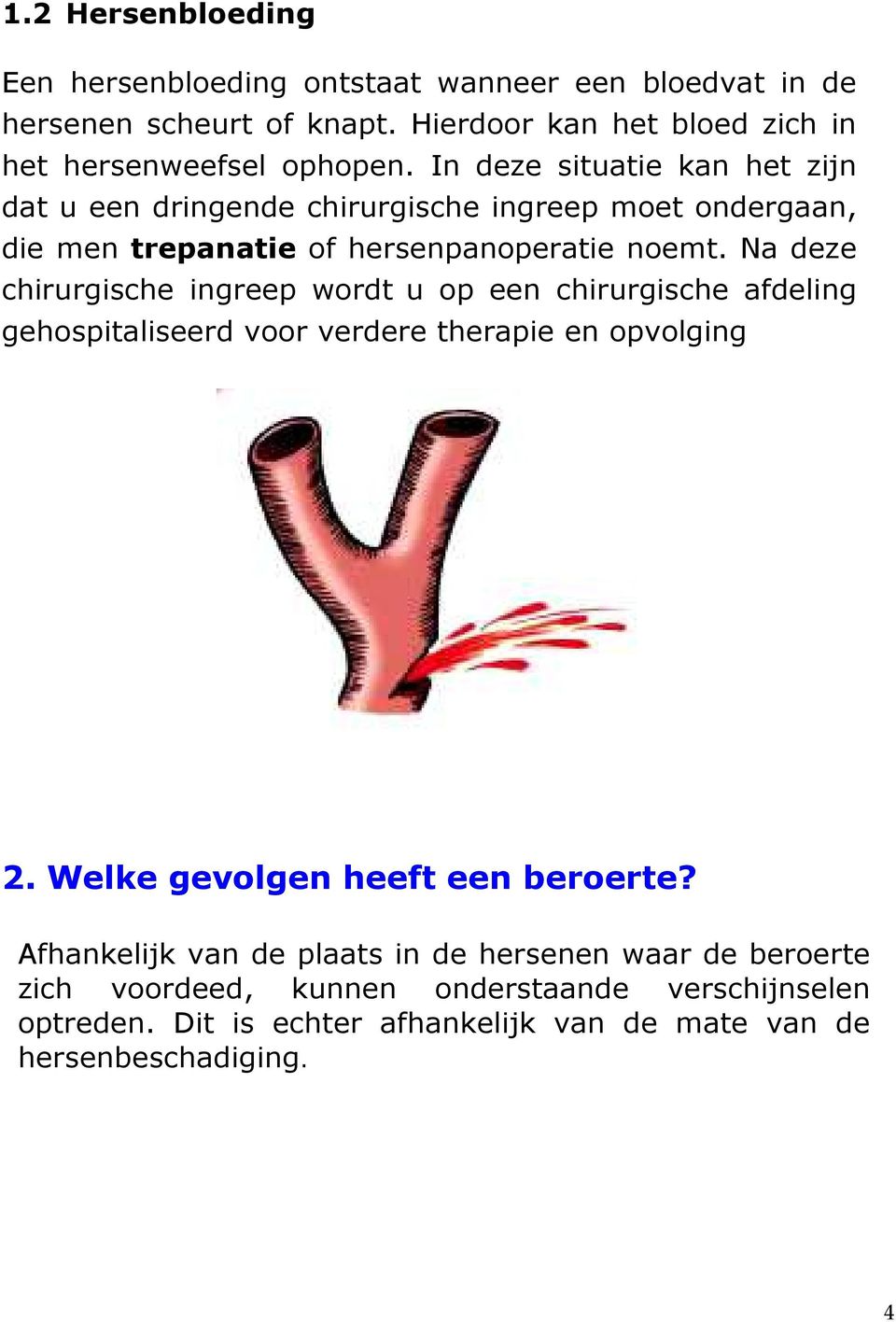 Na deze chirurgische ingreep wordt u op een chirurgische afdeling gehospitaliseerd voor verdere therapie en opvolging 2. Welke gevolgen heeft een beroerte?