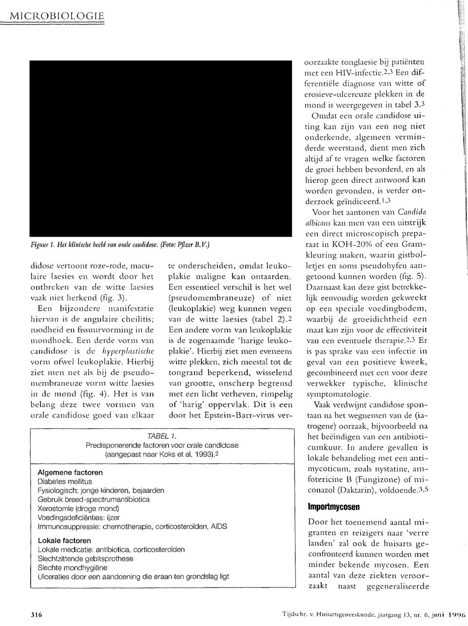 oorzaakte tonglaesie bij patiënten met een HlV-infectie.2,3 Een differentiële diagnose van witte of erosieve-ulcereuze plekken in de mond is weergegeven in tabel 3.