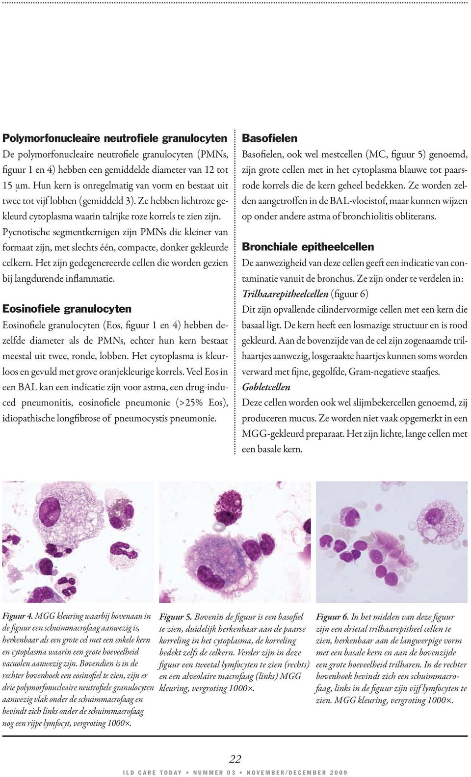 Pycnotische segmentkernigen zijn PMNs die kleiner van formaat zijn, met slechts één, compacte, donker gekleurde celkern. Het zijn gedegenereerde cellen die worden gezien bij langdurende inflammatie.