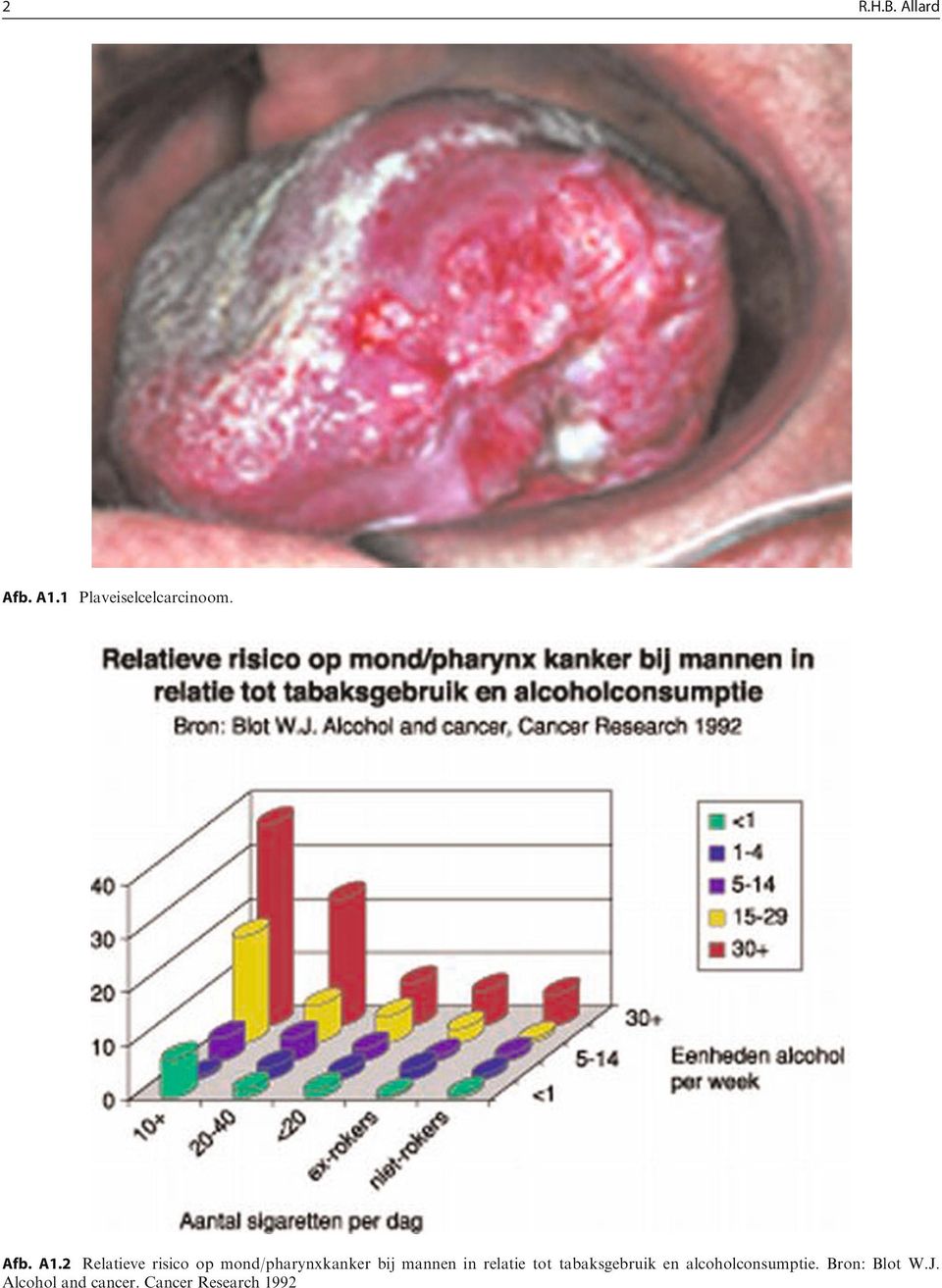 2 Relatieve risico op mond/pharynxkanker bij mannen