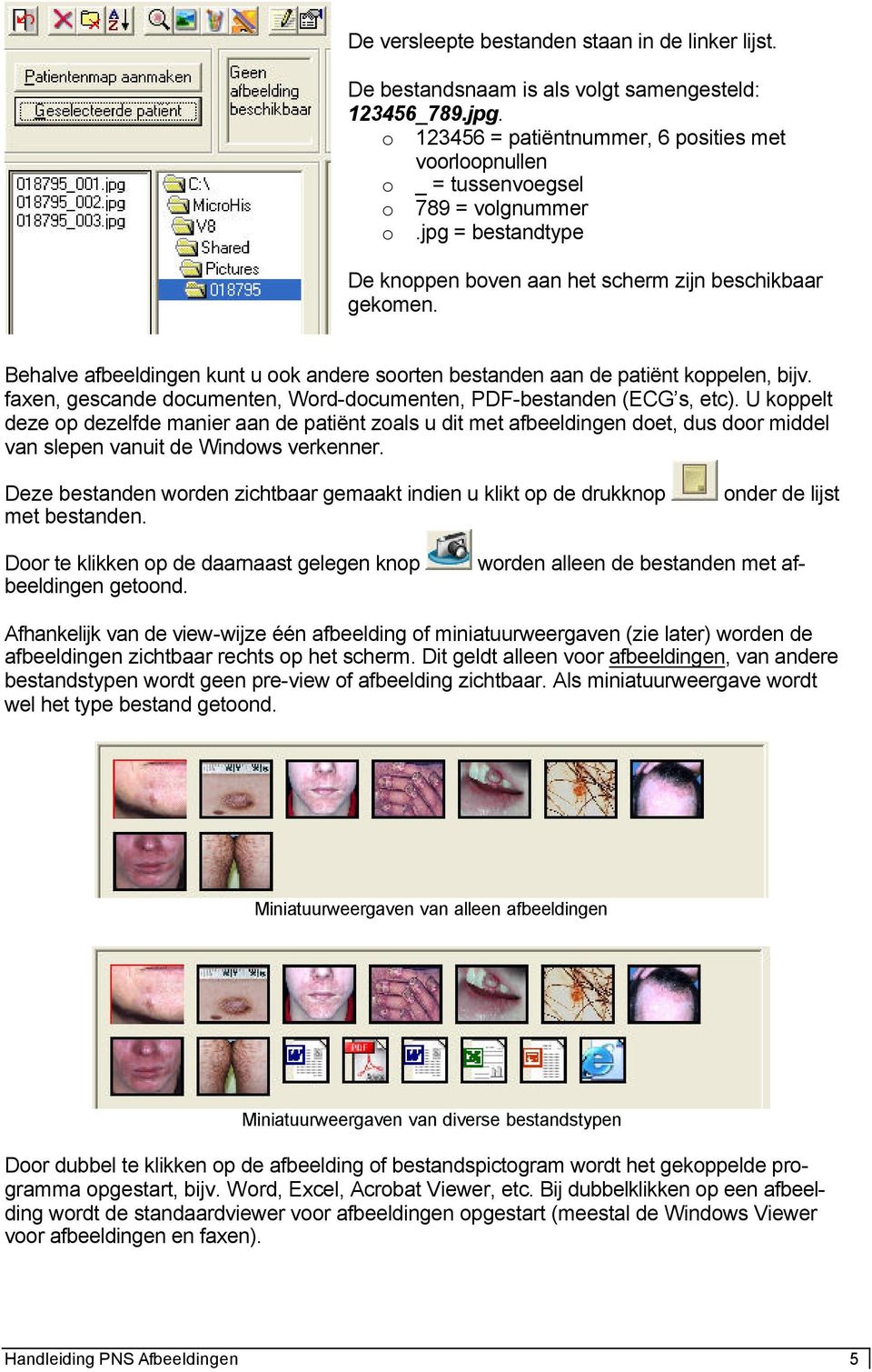 Behalve afbeeldingen kunt u ook andere soorten bestanden aan de patiënt koppelen, bijv. faxen, gescande documenten, Word-documenten, PDF-bestanden (ECG s, etc).