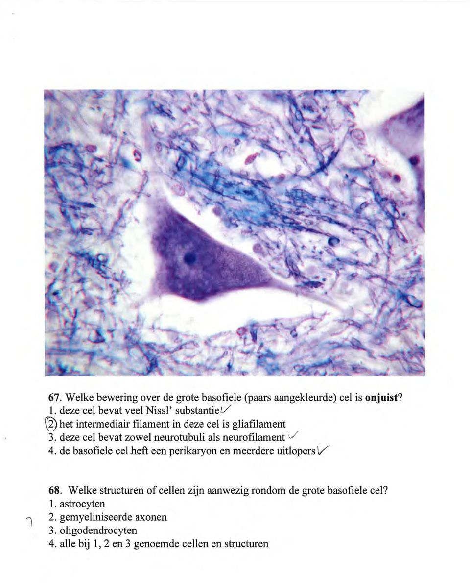 deze cel bevat zowel neurotubuli als neurofilament J 4. de basofiele celheft een perikaryon en meerdere uitlopers V 1 68.