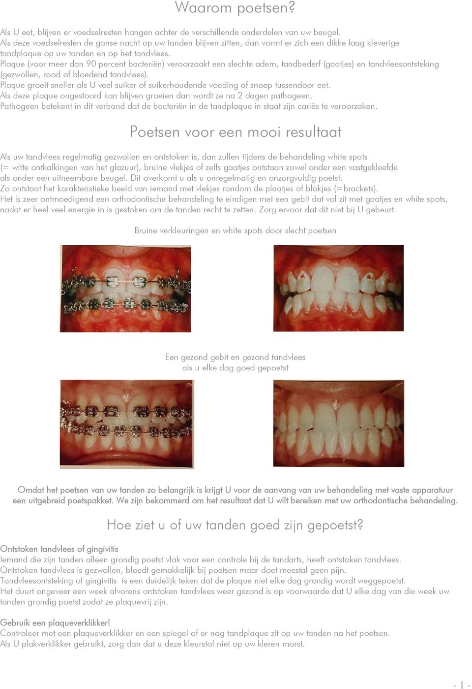 Plaque (voor meer dan 90 percent bacteriën) veroorzaakt een slechte adem, tandbederf (gaatjes) en tandvleesontsteking (gezwollen, rood of bloedend tandvlees).