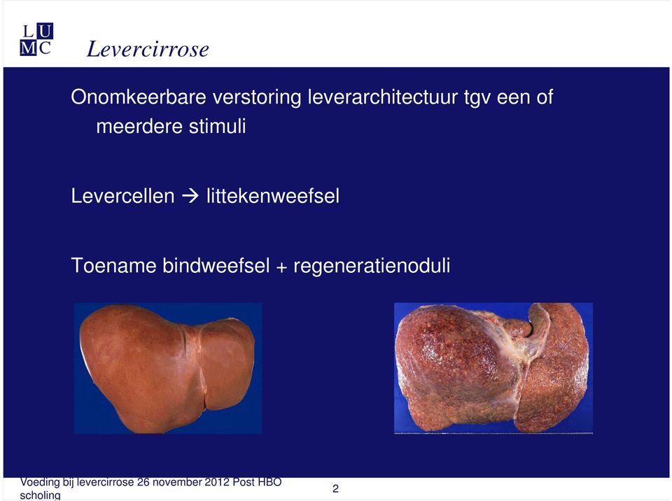 stimuli Levercellen littekenweefsel