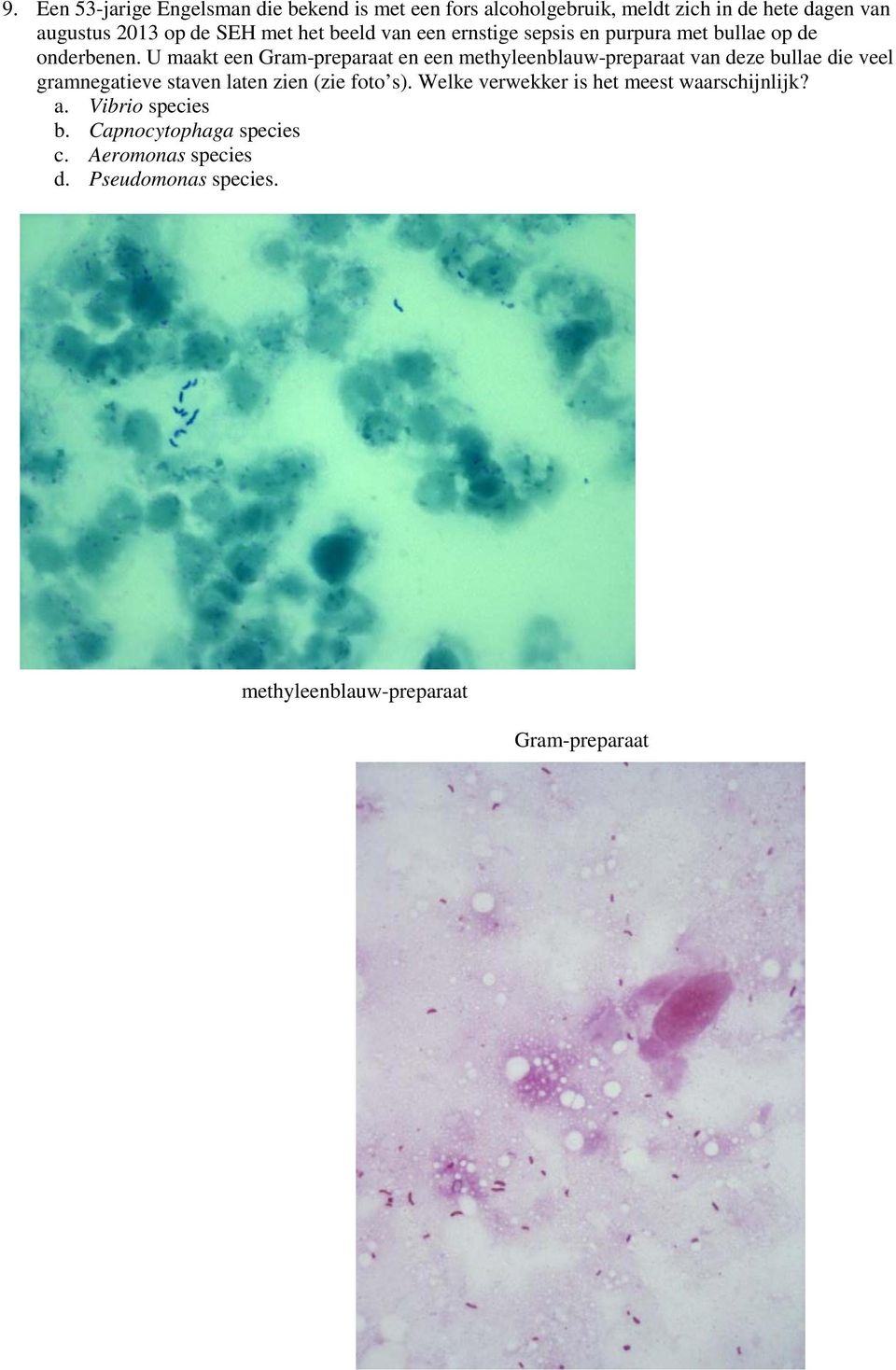 U maakt een Gram-preparaat en een methyleenblauw-preparaat van deze bullae die veel gramnegatieve staven laten zien (zie foto