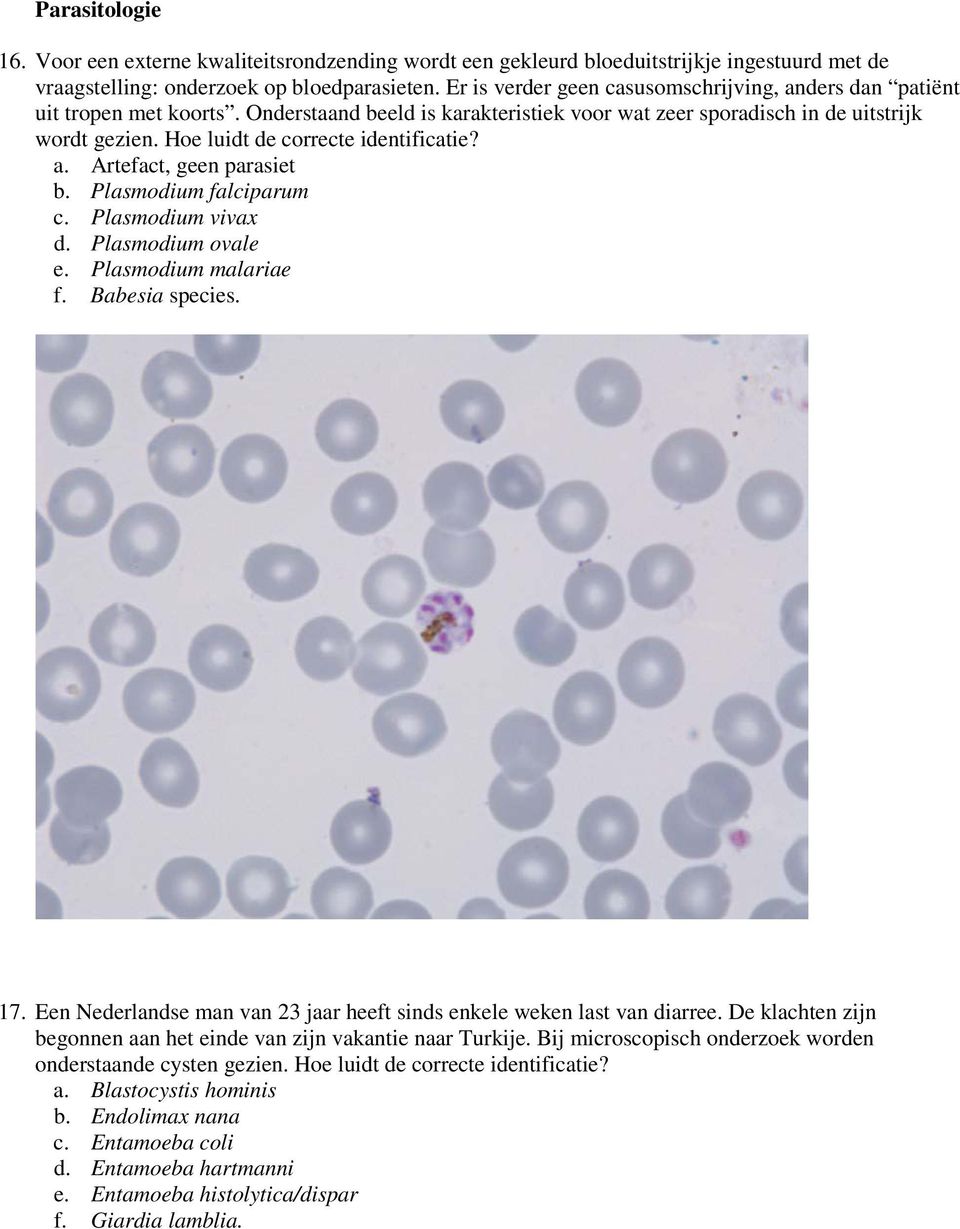 Hoe luidt de correcte identificatie? a. Artefact, geen parasiet b. Plasmodium falciparum c. Plasmodium vivax d. Plasmodium ovale e. Plasmodium malariae f. Babesia species. 17.