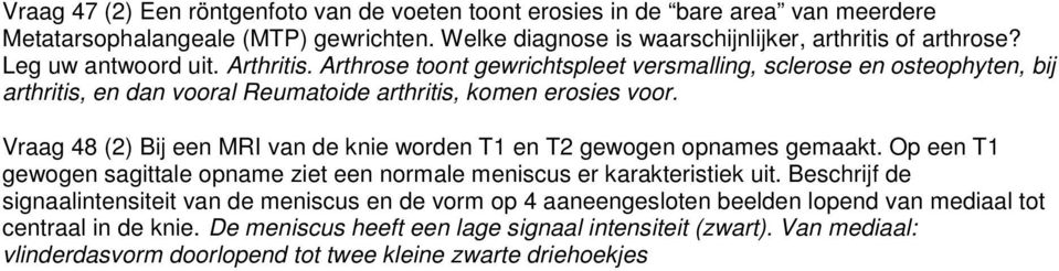 Vraag 48 (2) Bij een MRI van de knie worden T1 en T2 gewogen opnames gemaakt. Op een T1 gewogen sagittale opname ziet een normale meniscus er karakteristiek uit.