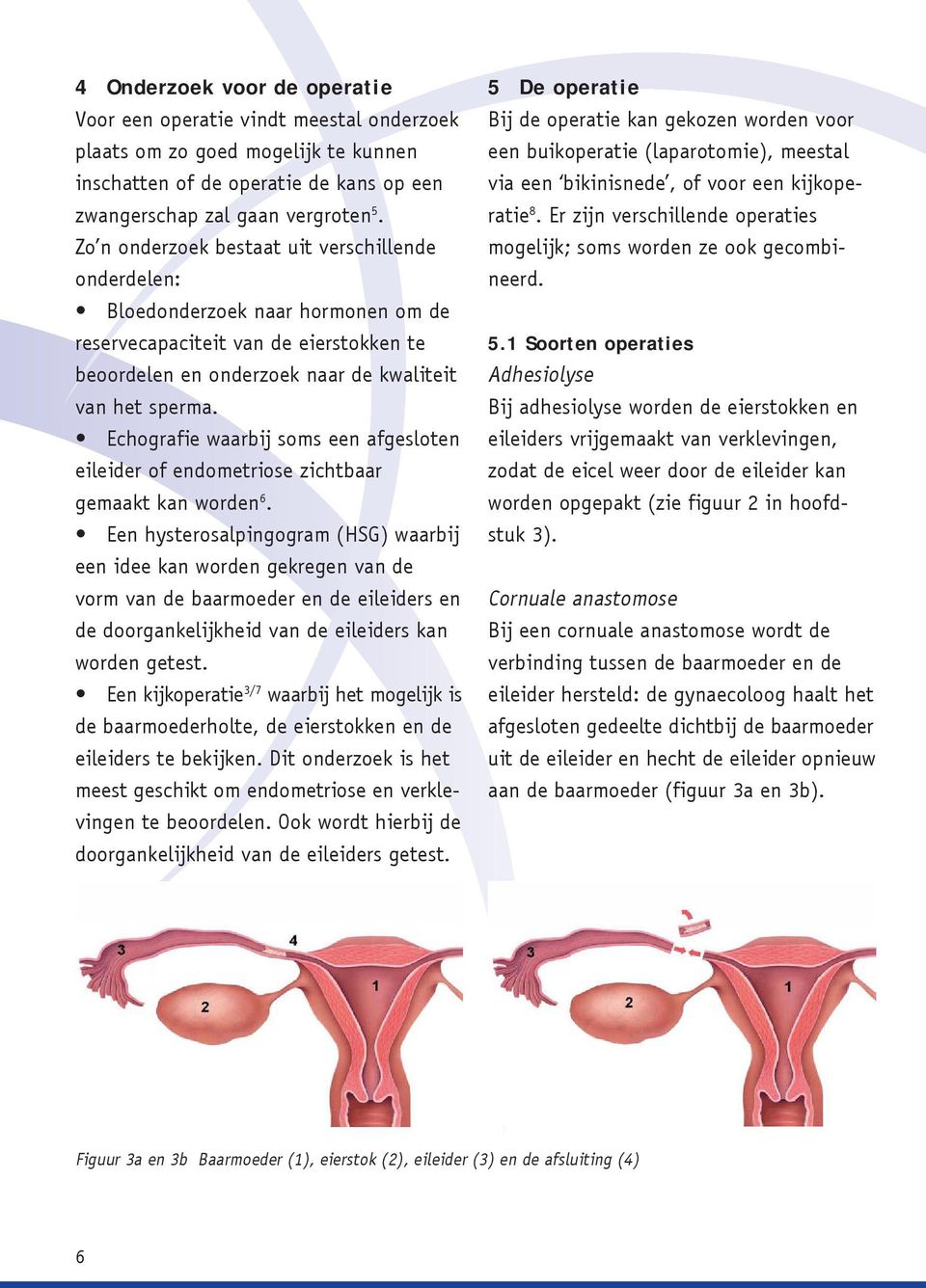 Echografie waarbij soms een afgesloten eileider of endometriose zichtbaar gemaakt kan worden 6.
