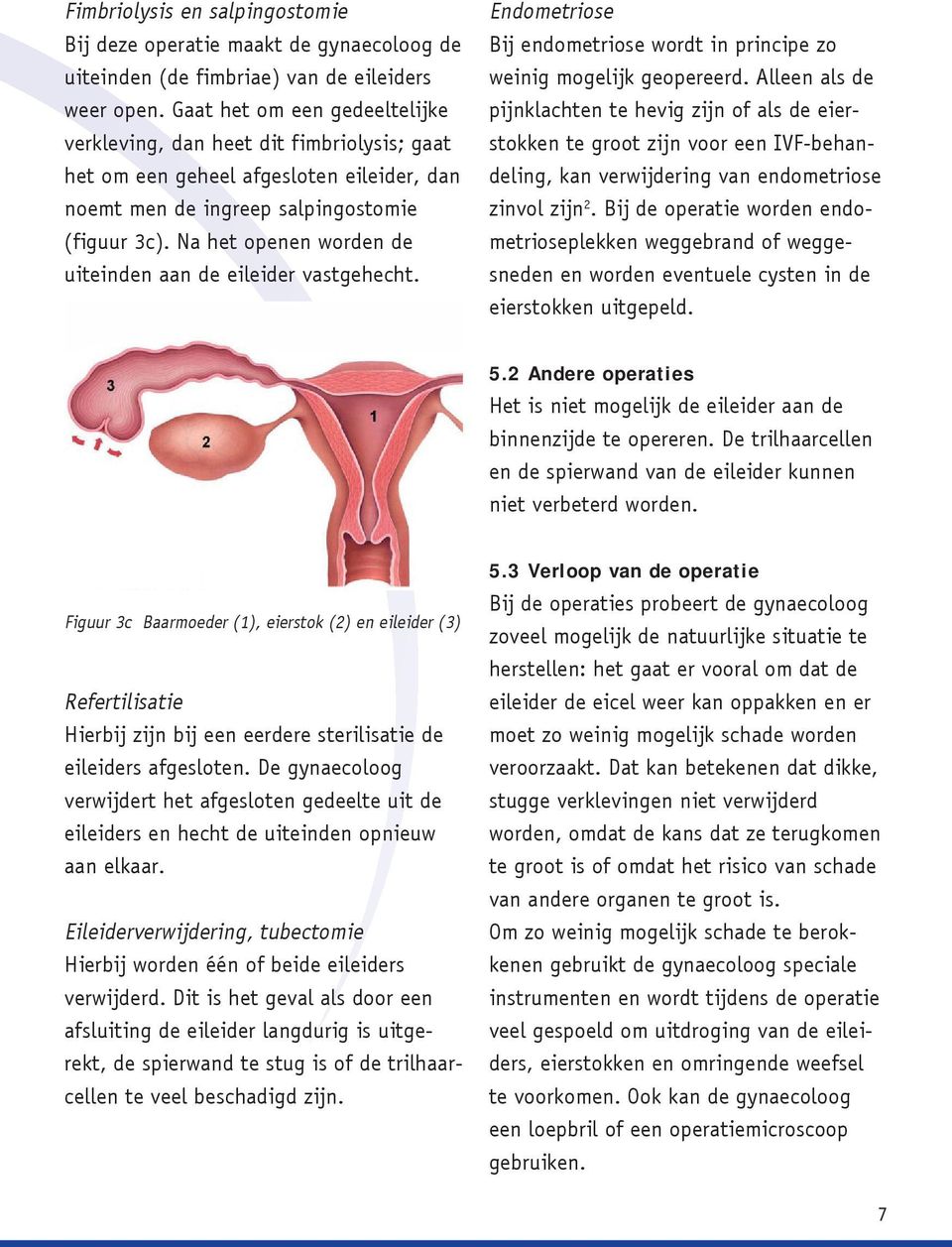 Na het openen worden de uiteinden aan de eileider vastgehecht. Endometriose Bij endometriose wordt in principe zo weinig mogelijk geopereerd.