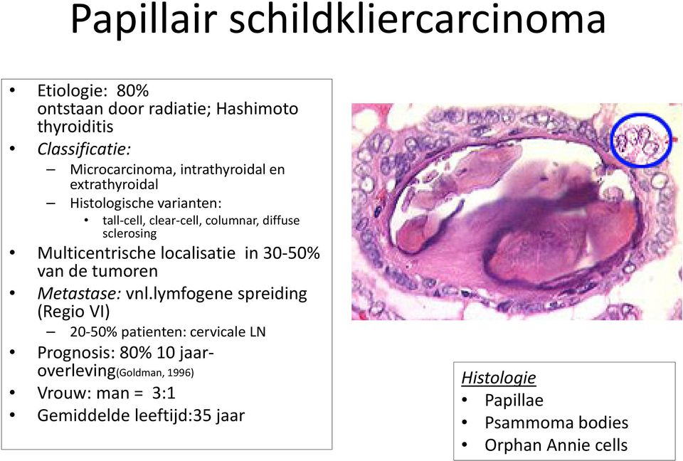 localisatie in 30-50% van de tumoren Metastase: vnl.