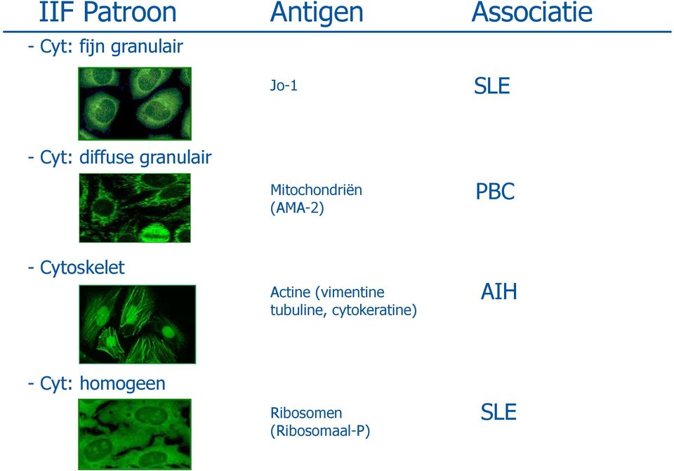 (AMA-2) PBC - Cytoskelet Actine (vimentine tubuline,