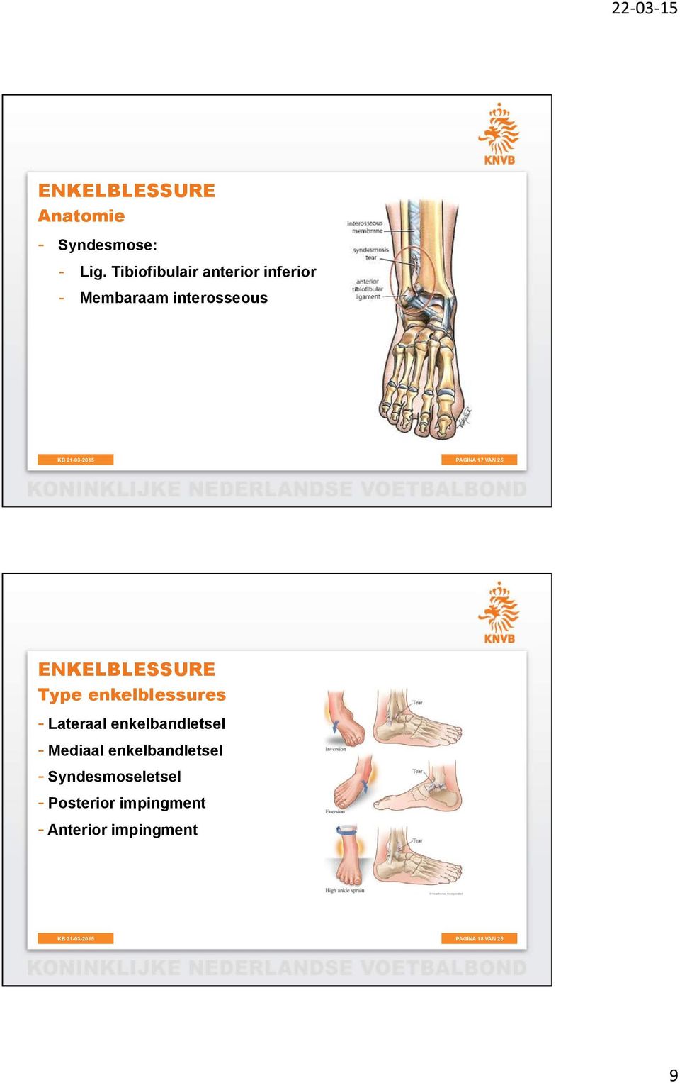 17 VAN 25 Type enkelblessures - Lateraal enkelbandletsel -