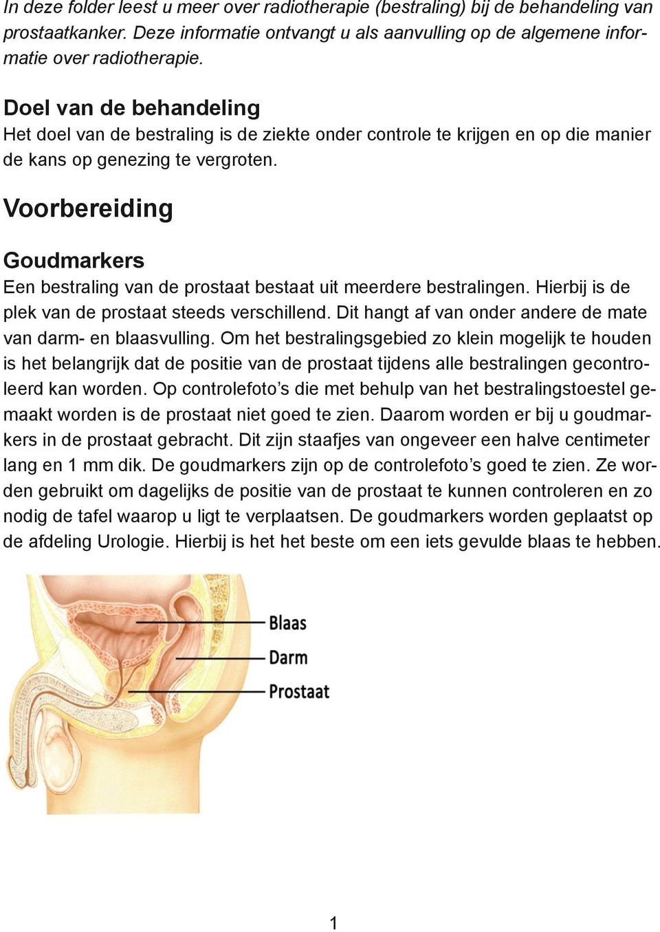 Voorbereiding Goudmarkers Een bestraling van de prostaat bestaat uit meerdere bestralingen. Hierbij is de plek van de prostaat steeds verschillend.