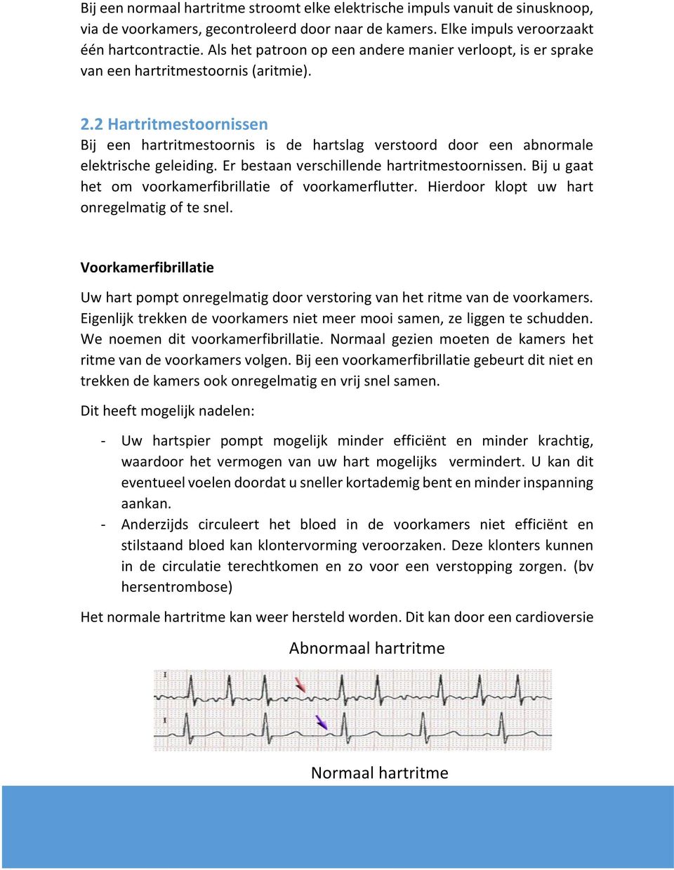 2 Hartritmestoornissen Bij een hartritmestoornis is de hartslag verstoord door een abnormale elektrische geleiding. Er bestaan verschillende hartritmestoornissen.