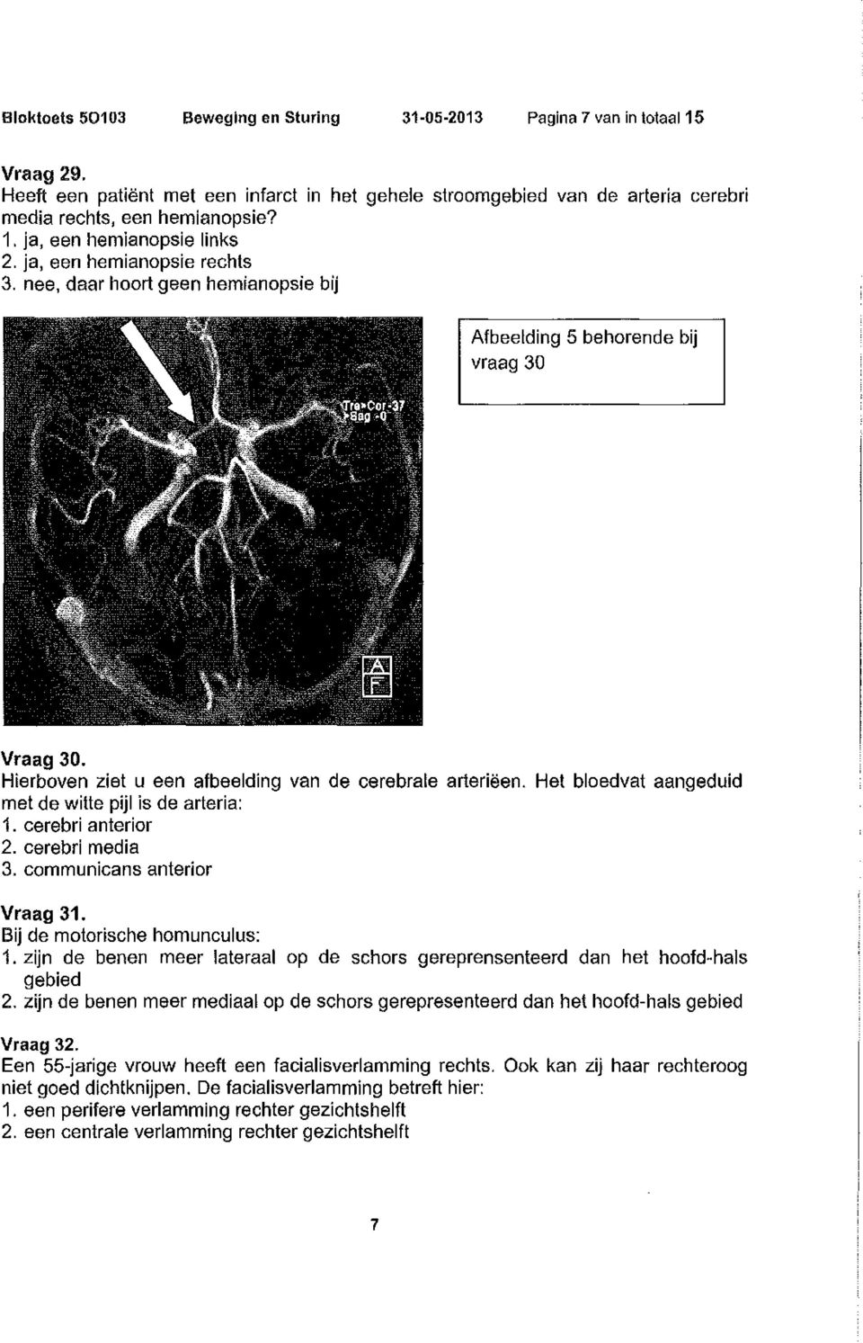 Het bloedvat aangeduid met de witte pijl is de arteria: 1. cerebri anterior 2. cerebri media 3. communicans anterior Vraag 31. Bij de motorische homunculus: 1.