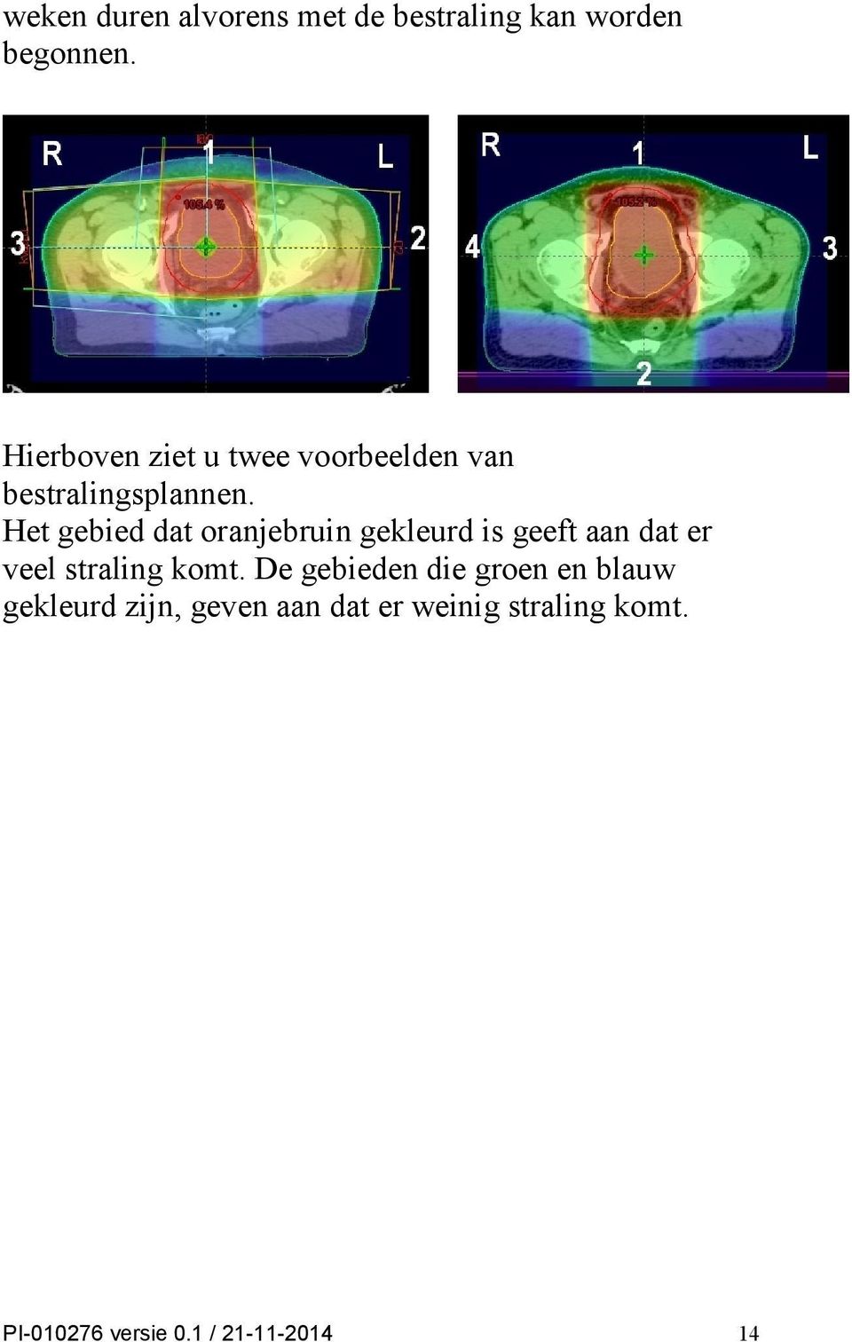 Het gebied dat oranjebruin gekleurd is geeft aan dat er veel straling komt.