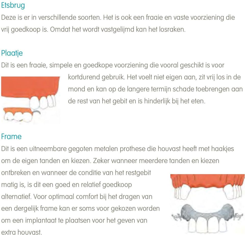 Het voelt niet eigen aan, zit vrij los in de mond en kan op de langere termijn schade toebrengen aan de rest van het gebit en is hinderlijk bij het eten.