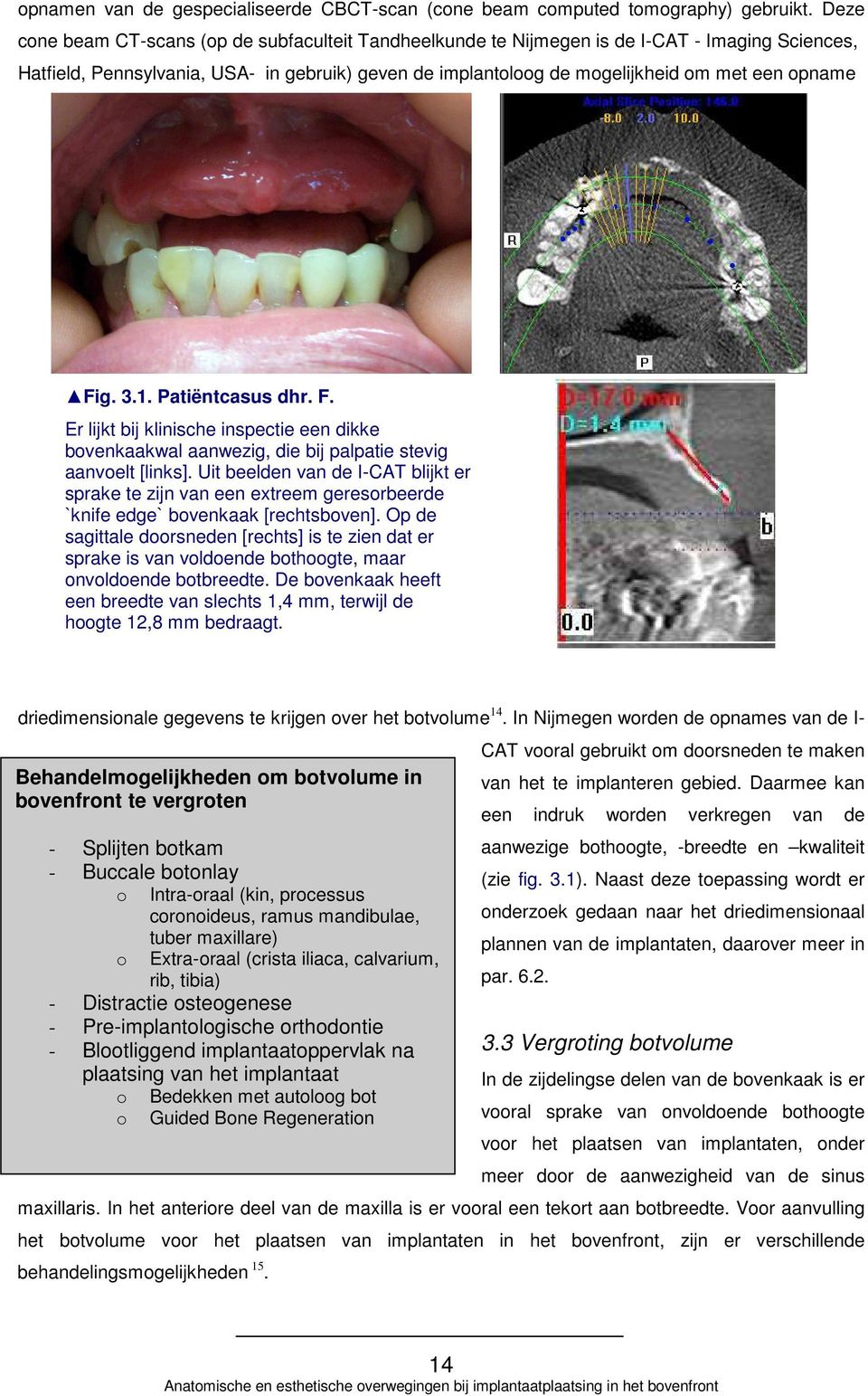 Fig. 3.1. Patiëntcasus dhr. F. Er lijkt bij klinische inspectie een dikke bovenkaakwal aanwezig, die bij palpatie stevig aanvoelt [links].