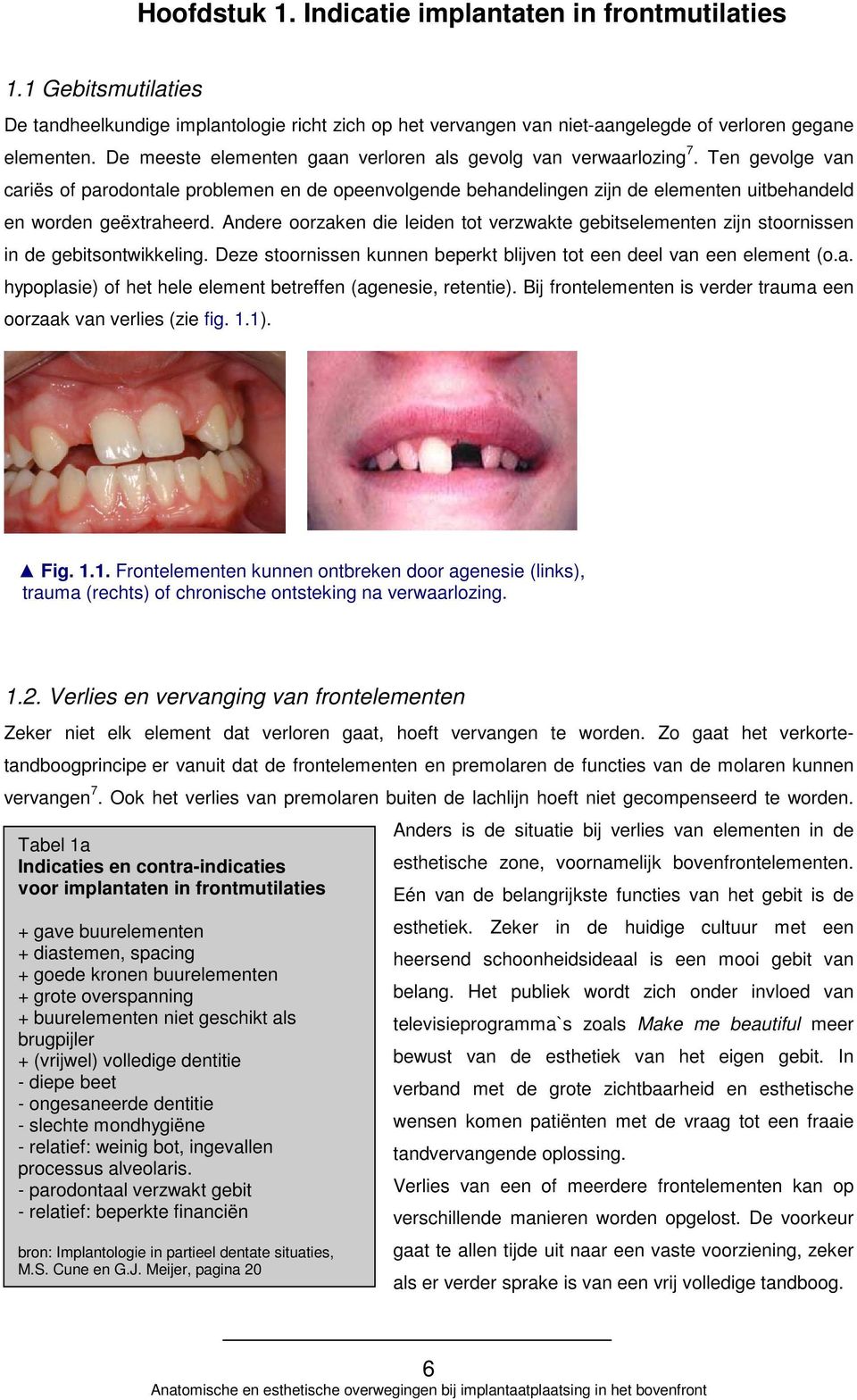 Ten gevolge van cariës of parodontale problemen en de opeenvolgende behandelingen zijn de elementen uitbehandeld en worden geëxtraheerd.