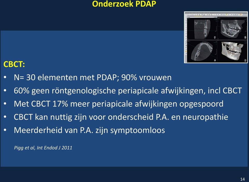 periapicale afwijkingen opgespoord CBCT kan nuttig zijn voor onderscheid P.