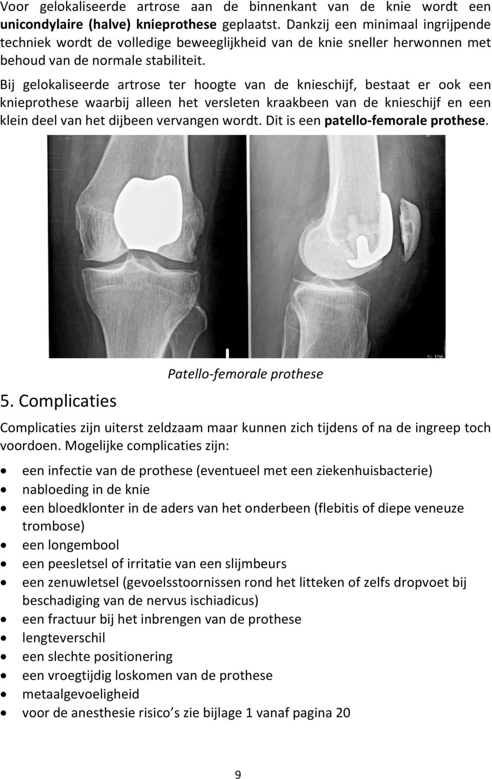 Bij gelokaliseerde artrose ter hoogte van de knieschijf, bestaat er ook een knieprothese waarbij alleen het versleten kraakbeen van de knieschijf en een klein deel van het dijbeen vervangen wordt.