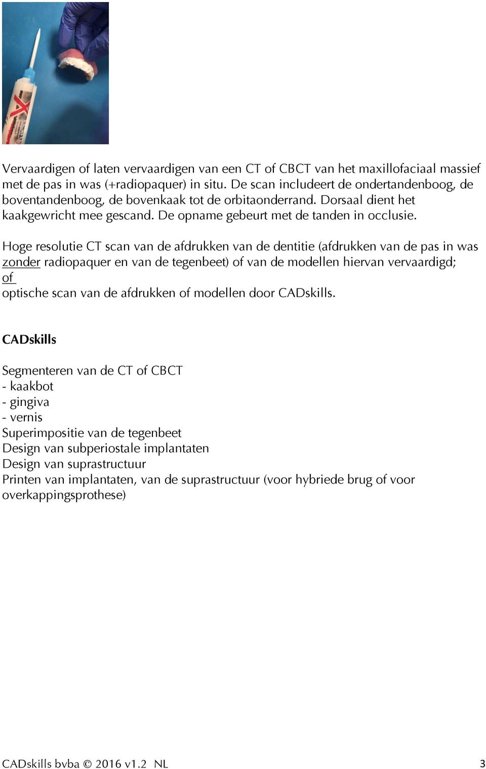 Hoge resolutie CT scan van de afdrukken van de dentitie (afdrukken van de pas in was zonder radiopaquer en van de tegenbeet) of van de modellen hiervan vervaardigd; of optische scan van de afdrukken