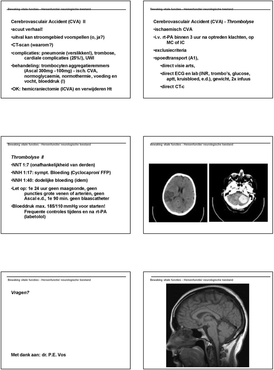 ) OK: hemicraniectomie (ICVA) en ve