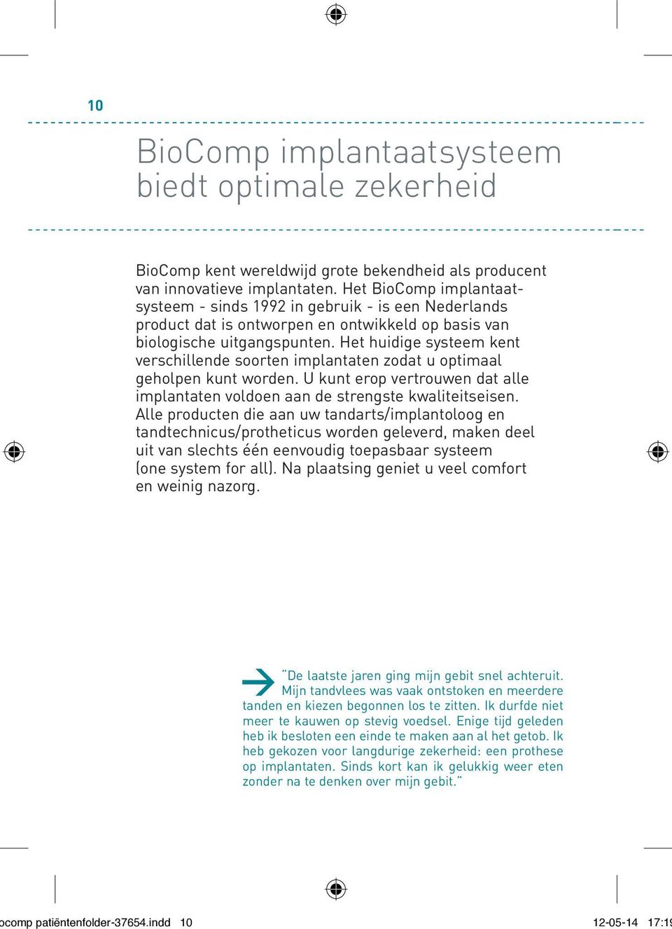 Het huidige systeem kent verschillende soorten implantaten zodat u optimaal geholpen kunt worden. U kunt erop vertrouwen dat alle implantaten voldoen aan de strengste kwaliteitseisen.