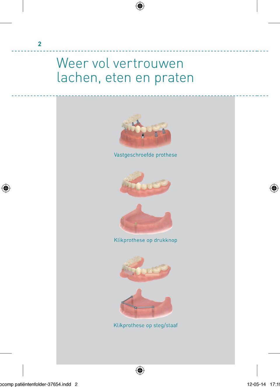 Klikprothese op drukknop Klikprothese op