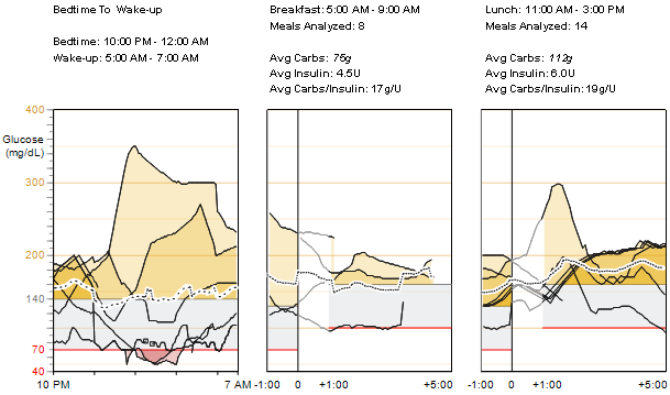 Glucose Sensor Overlay Bedtime To Wake-up and Meal Periods (Totaal van alle sensorglucosemetingen rond slapengaan/ opstaan en maaltijdperioden) Bedtime To Wake-up (Slapengaan/opstaan) Deze grafiek