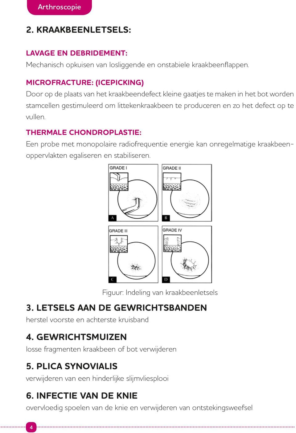 vullen. Thermale chondroplastie: Een probe met monopolaire radiofrequentie energie kan onregelmatige kraakbeenoppervlakten egaliseren en stabiliseren. Figuur: Indeling van kraakbeenletsels 3.