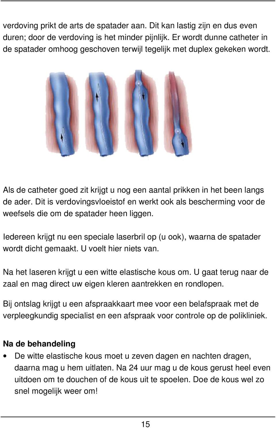 Dit is verdovingsvloeistof en werkt ook als bescherming voor de weefsels die om de spatader heen liggen. Iedereen krijgt nu een speciale laserbril op (u ook), waarna de spatader wordt dicht gemaakt.